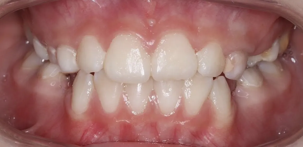 После лечения