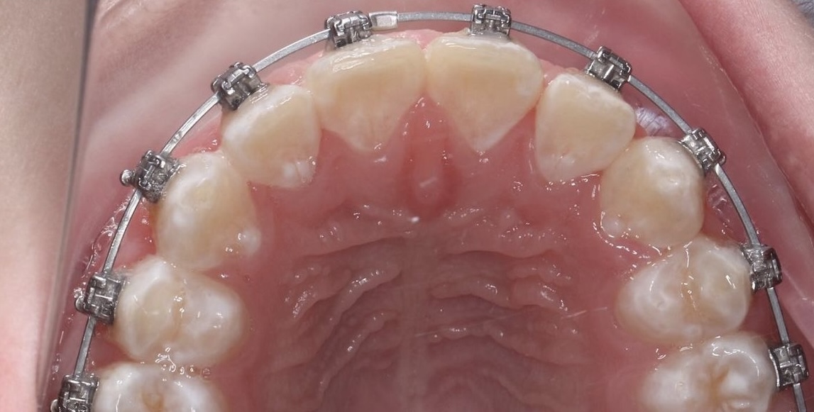 После лечения