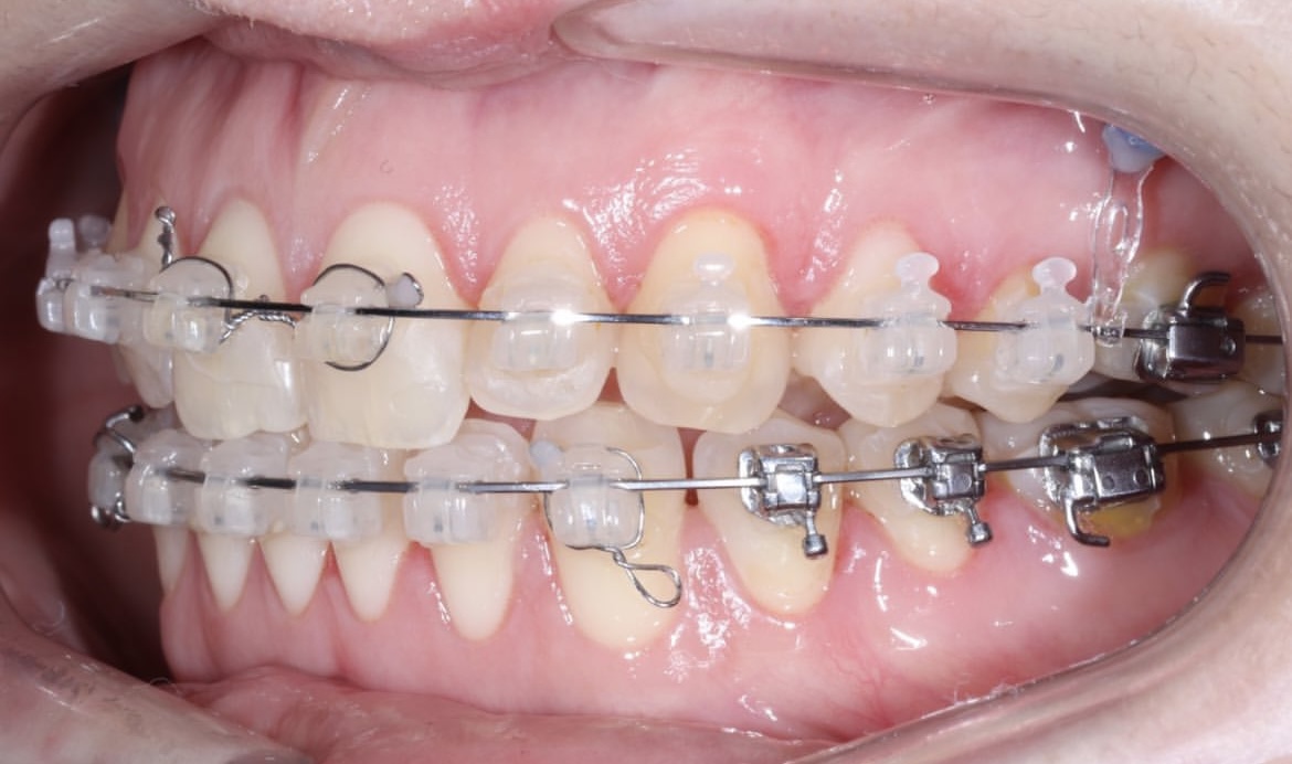 После лечения