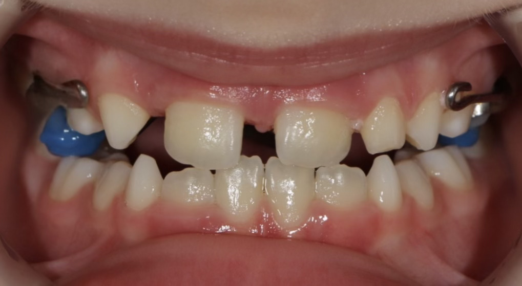 После лечения