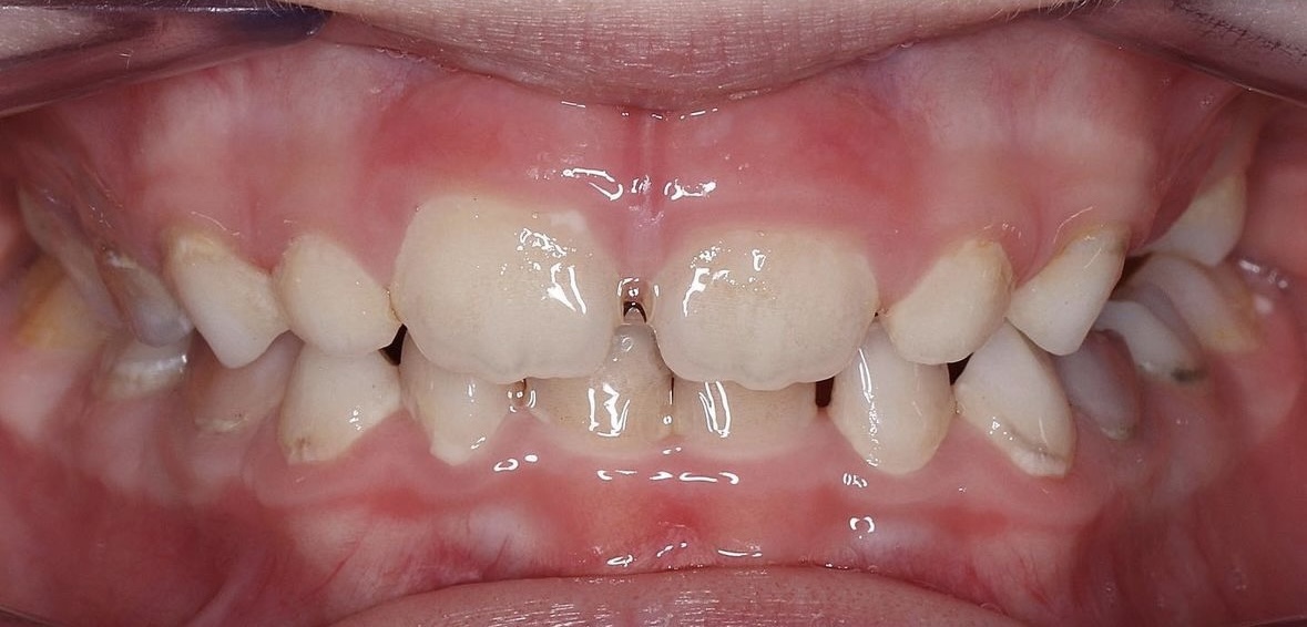 После лечения